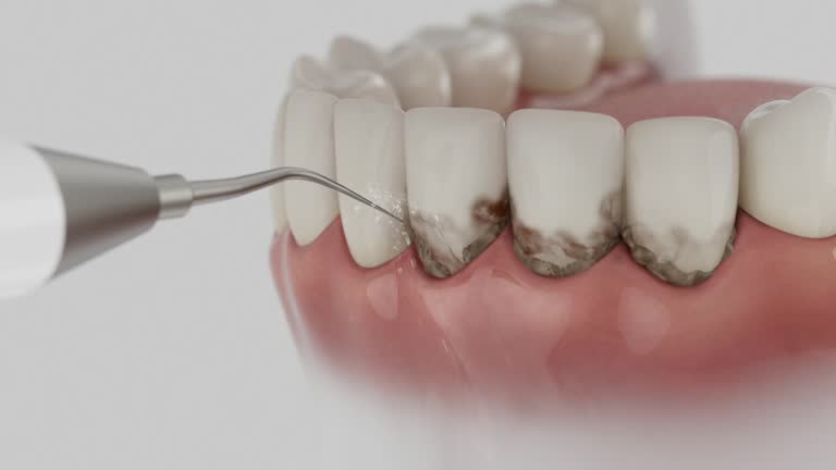 Trusted Invisalign Clear Aligners service in District Heights, MD - Dentist Open Now